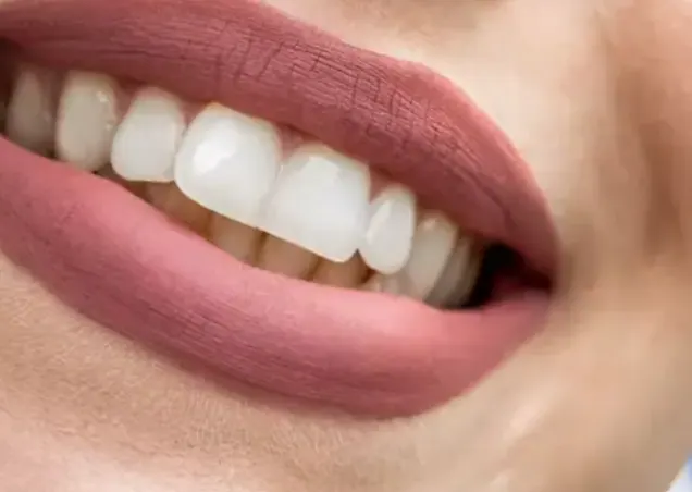 Sonrisa luminosa despu&eacute;s de un blanqueamiento dental